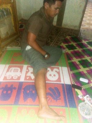 Lapor ke Polsek, Warga Ini Mengaku Sengaja Ditabrak dan Diancam Oknum Kades di Jangkat Timur