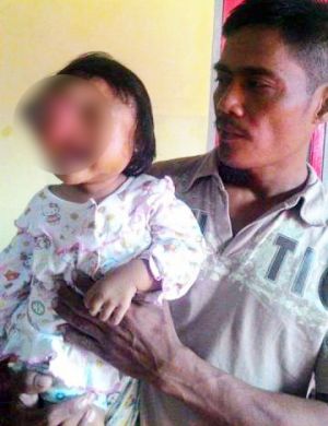 Menderita Kanker Mata, Balita Hafyza Butuh Bantuan   
