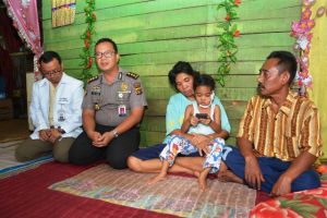 Cahaya Ilahi Pasien yang Menderita Tumor Sudah Dioperasi, Ayah: Terimakasih Pak Kapolda Jambi