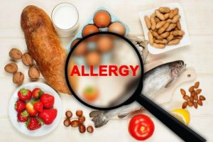 Alami Alergi Makanan, Ini Obat Alergi yang Alami