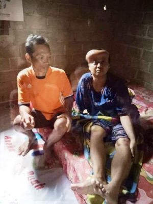 Warga Tidak Mampu ini Perlu Bantuan Setelah Diserang Tumor Otak