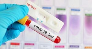 Batasan Biaya Tertinggi Rapid Test Rp150 Ribu Berlaku untuk Pasien Mandiri