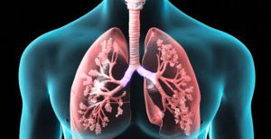 Penyintas Kanker Paru Berisiko Tinggi Terpapar Virus Corona