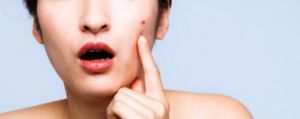 Cara Sederhana Mencegah Jerawat di Hidung